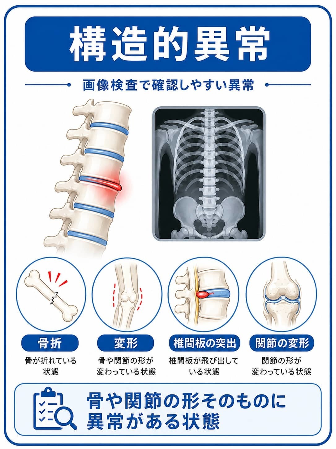 レントゲンやMRIなどの画像検査で確認しやすい構造的異常として、骨折、変形、椎間板の突出、関節の変形などを説明する図解