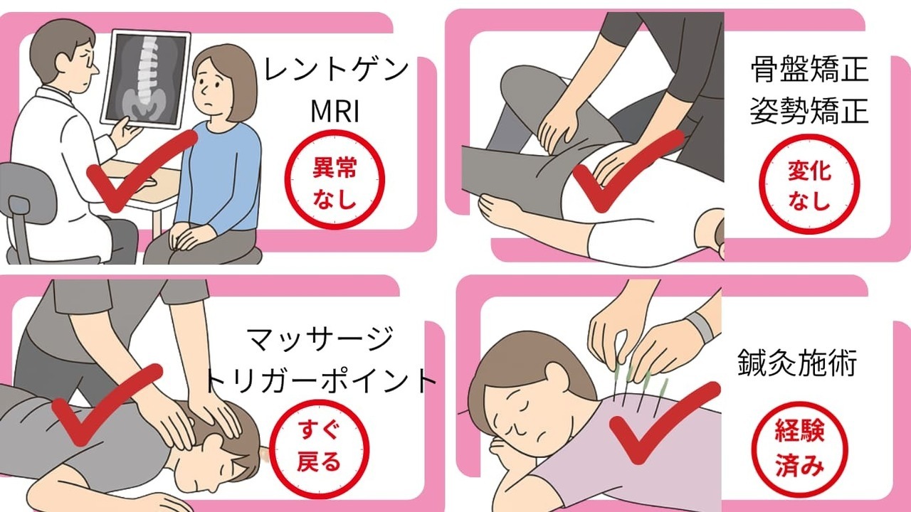 レントゲンやMRIで異常なしと言われ、骨盤矯正やマッサージ、鍼灸施術を受けても改善しなかった慢性的な痛みのイメージ図