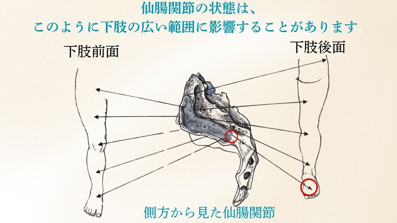 仙腸関節から下肢へ影響が広がる様子を示した図。前面・後面の下肢に関連する領域を示している