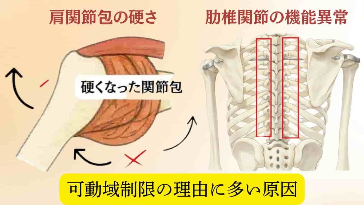 「四十肩・五十肩で腕が上がらない原因として、肩関節包の硬さと肋椎関節の機能異常を示した図解」