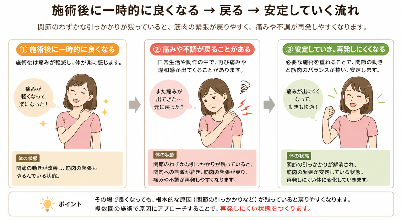 姫路市の鍼灸整骨院一心堂における施術後の変化を示す図。施術後に一時的に痛みが軽くなった後、日常生活の負担で痛みや不調が戻ることがあり、施術を重ねながら痛みや動きにくさが安定していく流れを説明しています。