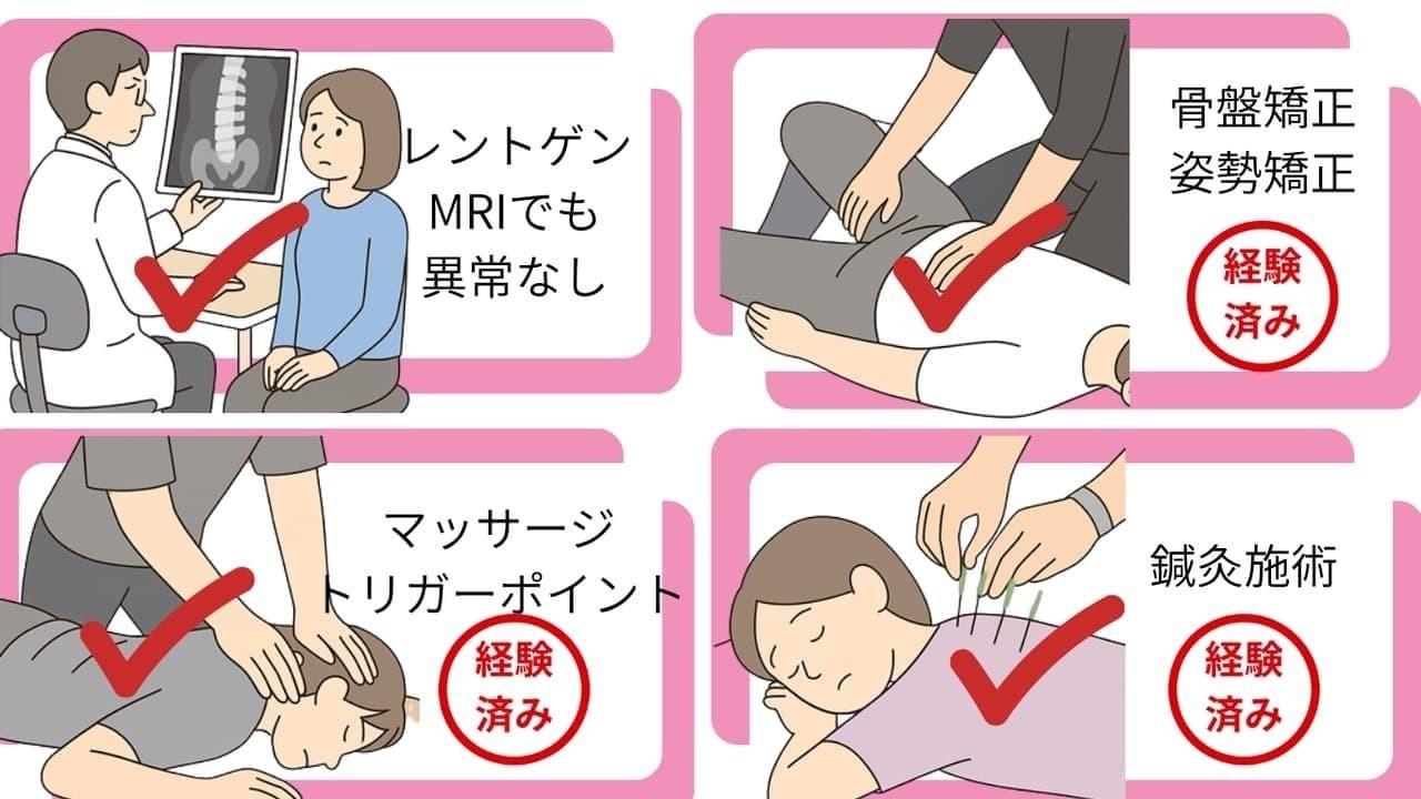 「レントゲンやMRIでは異常なし、骨盤矯正・姿勢矯正、マッサージやトリガーポイント療法、鍼灸施術などを経験しても症状が改善しなかった女性のイラスト。各治療法に赤いチェックマークと『経験済み』の印が表示されている。」