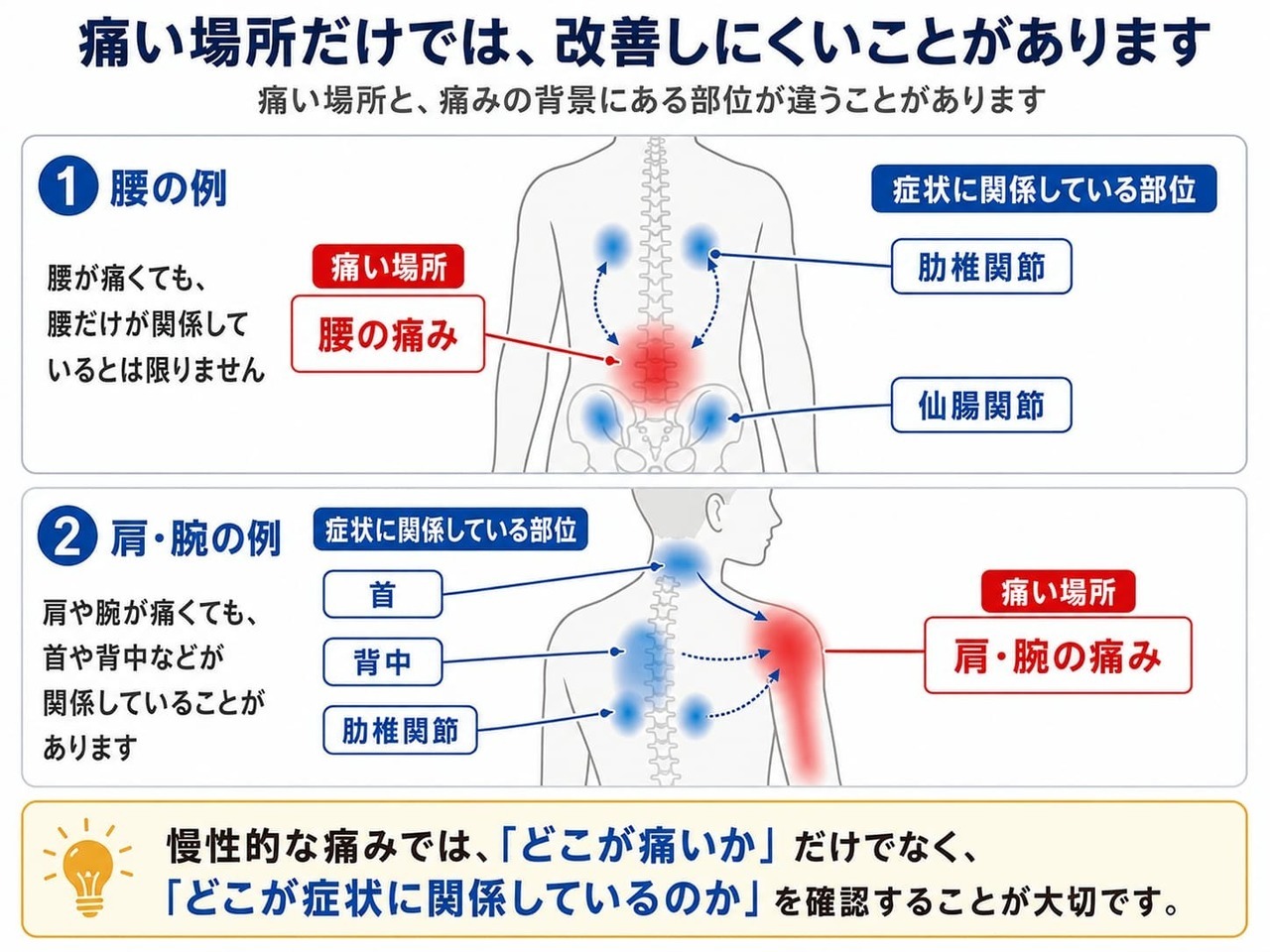 痛い場所と症状に関係している部位が異なる場合があることを、腰痛や肩・腕の痛みを例に説明する図解
