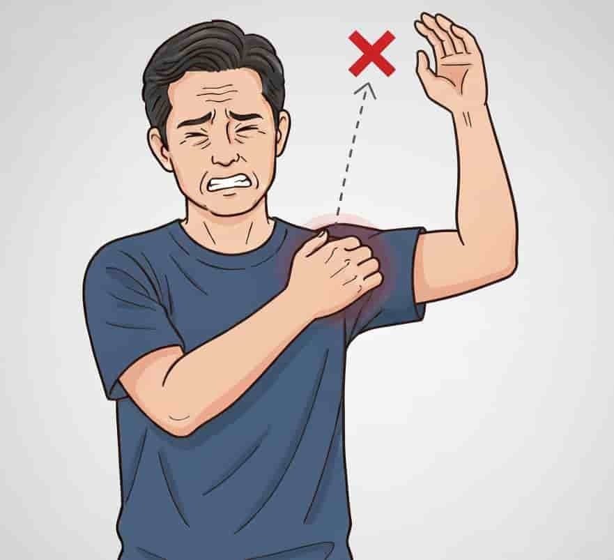 四十肩・五十肩の拘縮期に、肩が動かず痛みを感じている男性のイラスト。 腕を上げようとして肩の痛みに表情をしかめ、肩関節に赤い×印が描かれている（姫路市の鍼灸整骨院一心堂）。