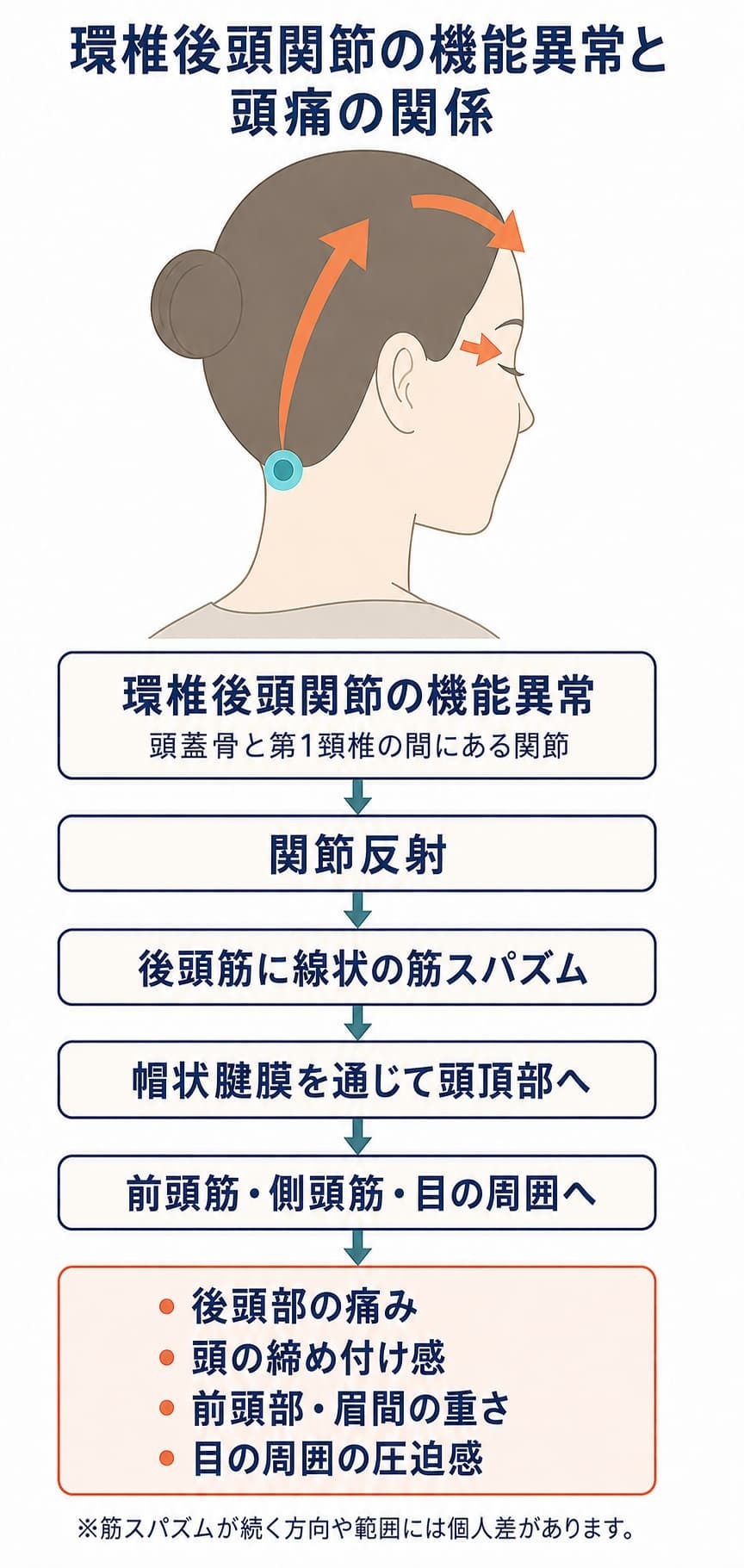 環椎後頭関節の機能異常から頭頂部や前頭部へ筋スパズムが続く方向を示した図