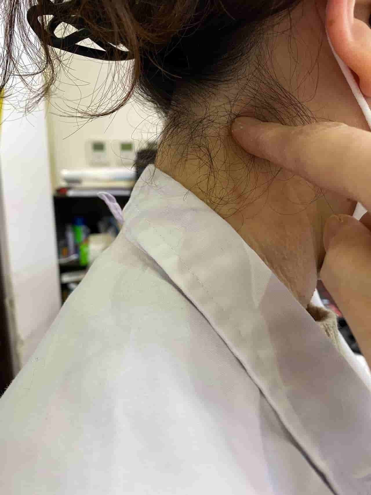施術部位