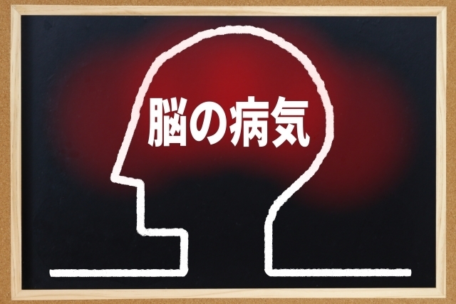 二次性頭痛の原因となる脳の病気を示した頭部のイラスト