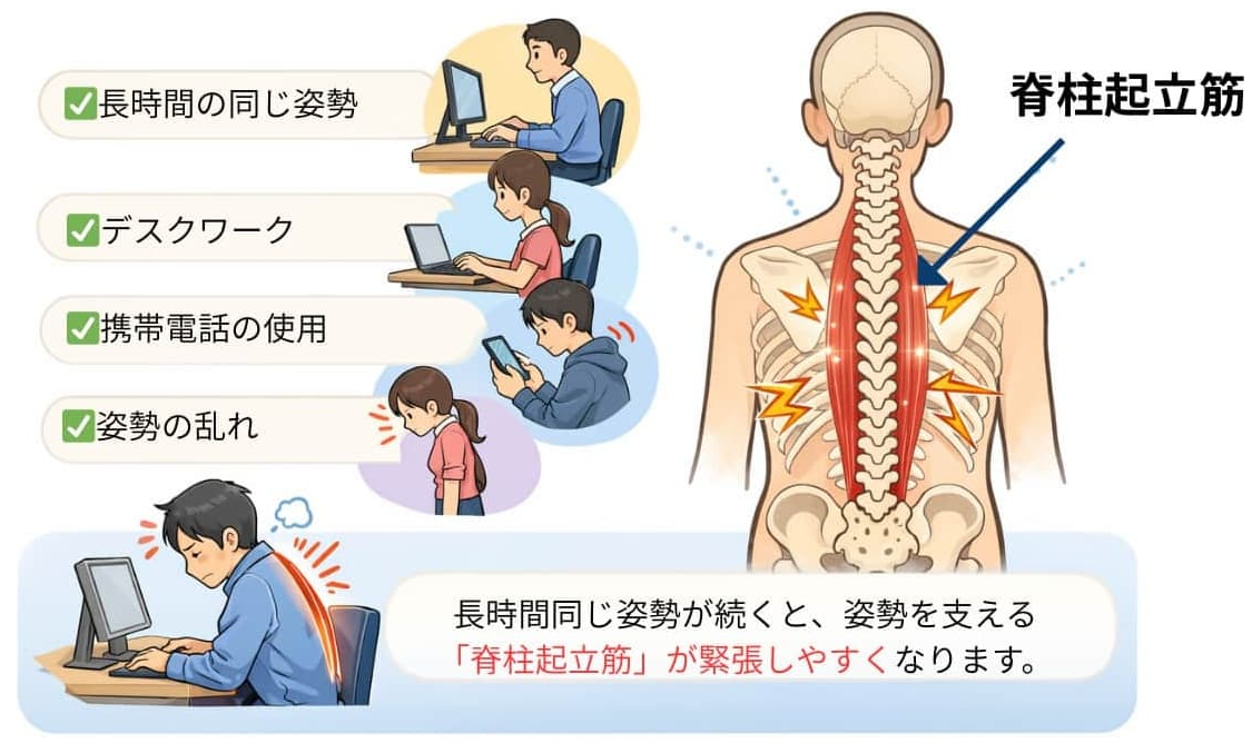 長時間の同じ姿勢やデスクワークによって脊柱起立筋が緊張し背中の張りが出るイメージ図