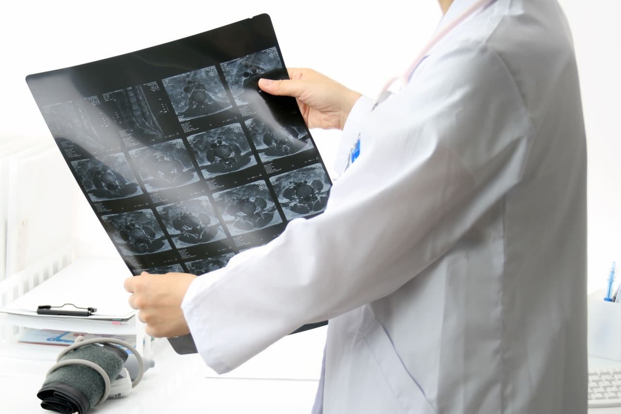 レントゲン画像を確認する医師。腰痛の多くは画像検査では異常が見つからず、関節や軟部組織の機能異常が原因となることがあります。