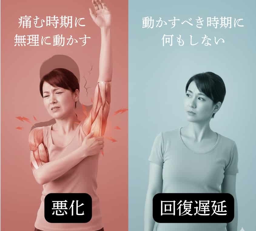 四十肩・五十肩において、痛みの時期ごとの対応の違いと回復への影響を示した比較イメージ