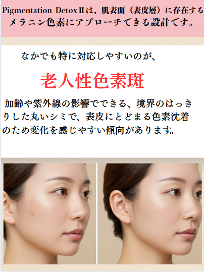 姫路市 シミケア 老人性色素斑 画像
