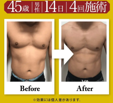 40歳　女性　週２回（８回目）の施術事例befor、After
