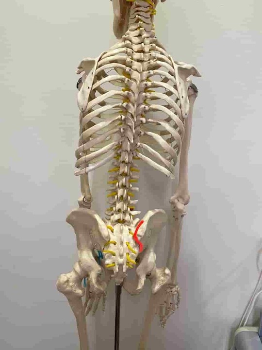 施術部位（赤いラインで右仙腸関節を表している）