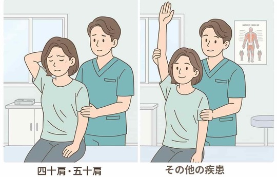 「四十肩・五十肩とその他の疾患の違いを示す図：拘縮によって肩の可動域が狭くなる五十肩と、他動ではスムーズに上がる他の疾患の比較イラスト（姫路市・鍼灸整骨院一心堂）」