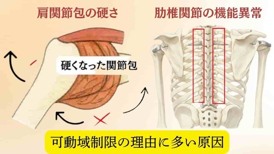 「四十肩・五十肩で腕が上がらない原因として、肩関節包の硬さと肋椎関節の機能異常を示した図解」