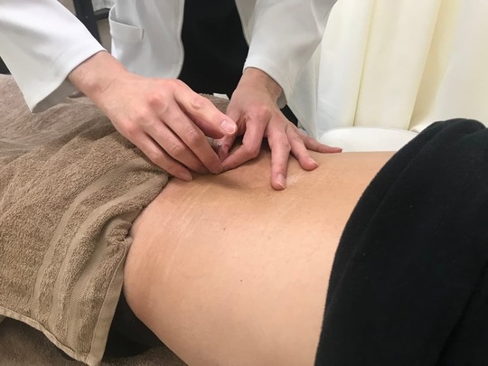 「姫路市の鍼灸整骨院一心堂 鍼灸施術の様子。腰部に鍼を打ち、トリガーポイントやツボを刺激して痛みの軽減や血流改善、柔軟性向上を図っている風景」