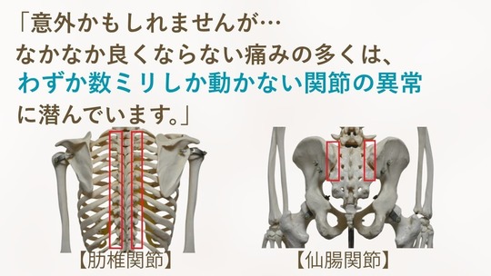 意外かもしれませんが、なかなか良くならない痛みの多くは、わずか数ミリしか動かない関節の異常に潜んでいることを示す説明画像。肋椎関節と仙腸関節の模型写真に赤枠で部位を強調し、慢性痛の原因が関節機能異常にある可能性を伝えています。
