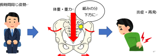 長時間同じ姿勢で座ることで骨盤や腰に重力が加わり、関節のゆるみが炎症や再発につながる仕組みを示す図（姫路市の鍼灸整骨院一心堂）」