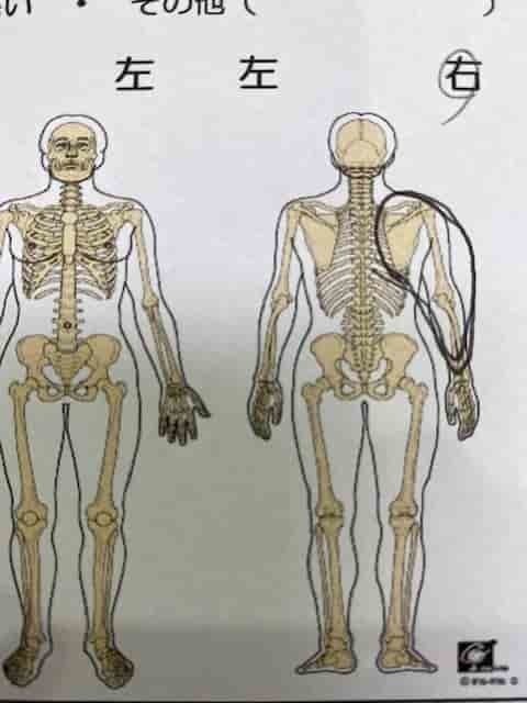 右腕が横に上らない　問診表