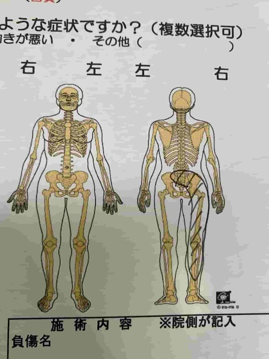 右腰から右太もも痛み・しびれの問診票
