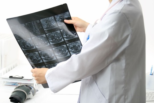 レントゲン画像を確認する医師。腰痛の多くは画像検査では異常が見つからず、関節や軟部組織の機能異常が原因となることがあります。