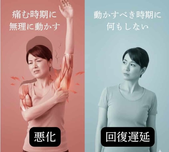 四十肩・五十肩において、痛みの時期ごとの対応の違いと回復への影響を示した比較イメージ