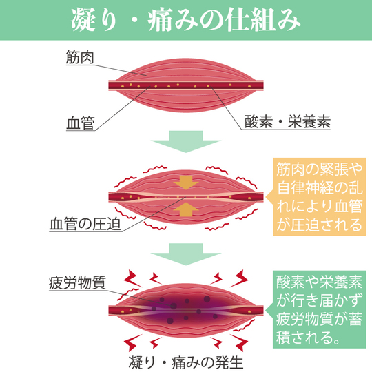 一般的な「肩こり」の仕組みと原因｜【姫路市】鍼灸整骨院一心堂