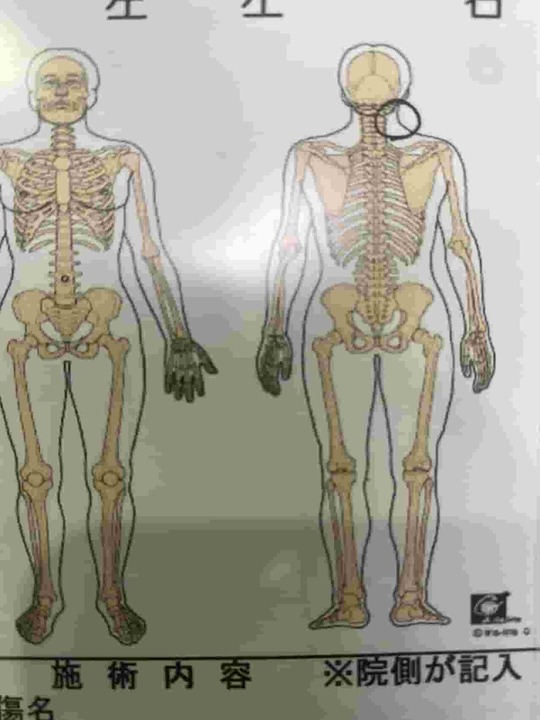 右首の痛み　問診表