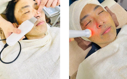 姫路市プレジールで毛穴洗浄とLEDフェイシャル施術を受ける男性｜メンズエステ